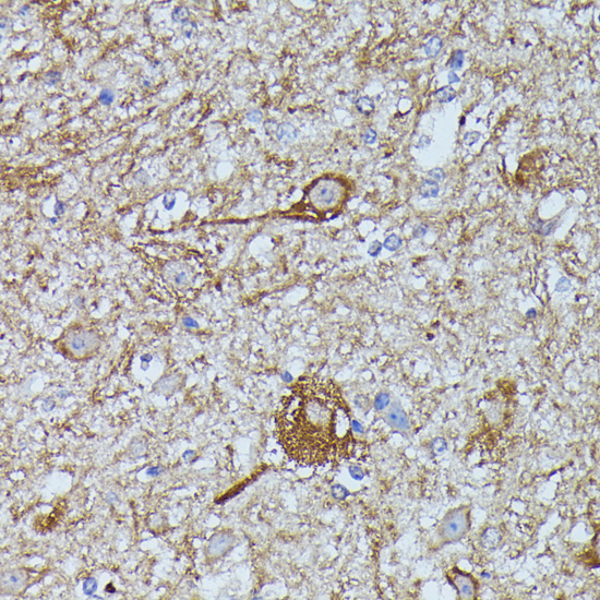 Immunohistochemistry - FKBP1B Polyclonal Antibody 