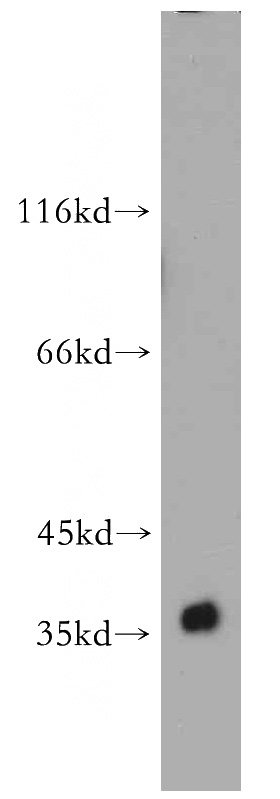human brain tissue were subjected to SDS PAGE followed by western blot with Catalog No:111718(ELAVL3 antibody) at dilution of 1:200