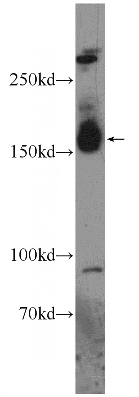 mouse brain tissue were subjected to SDS PAGE followed by western blot with Catalog No:111886(JMJD3 Antibody) at dilution of 1:600