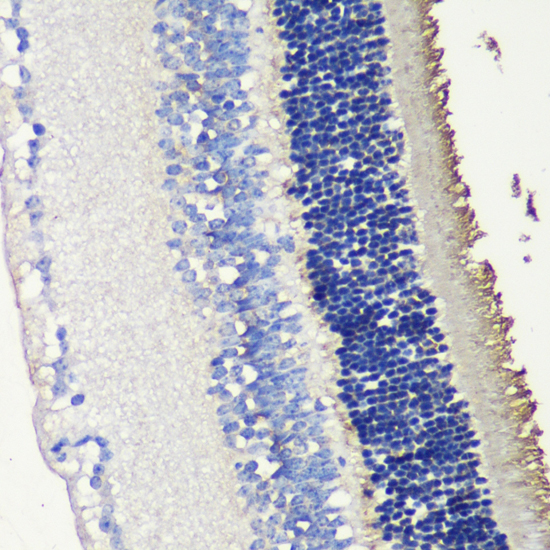 Immunohistochemistry - SAG Polyclonal Antibody 