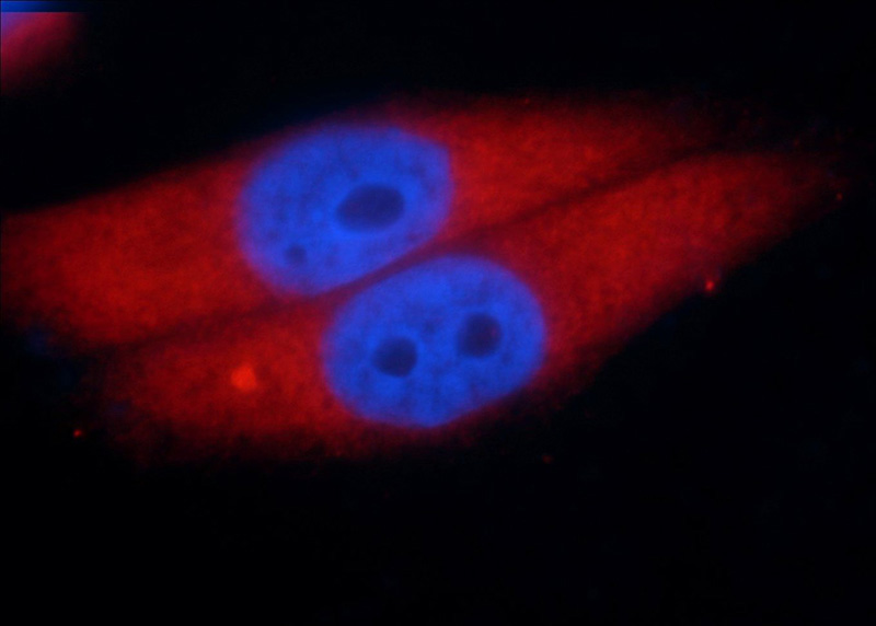 Immunofluorescent analysis of HepG2 cells using Catalog No:107571(ALDoc Antibody) at dilution of 1:50 and Rhodamine-Goat anti-Mouse IgG