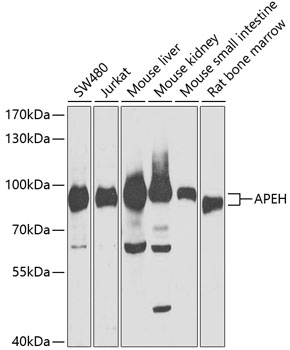 Western blot - APEH Polyclonal Antibody 