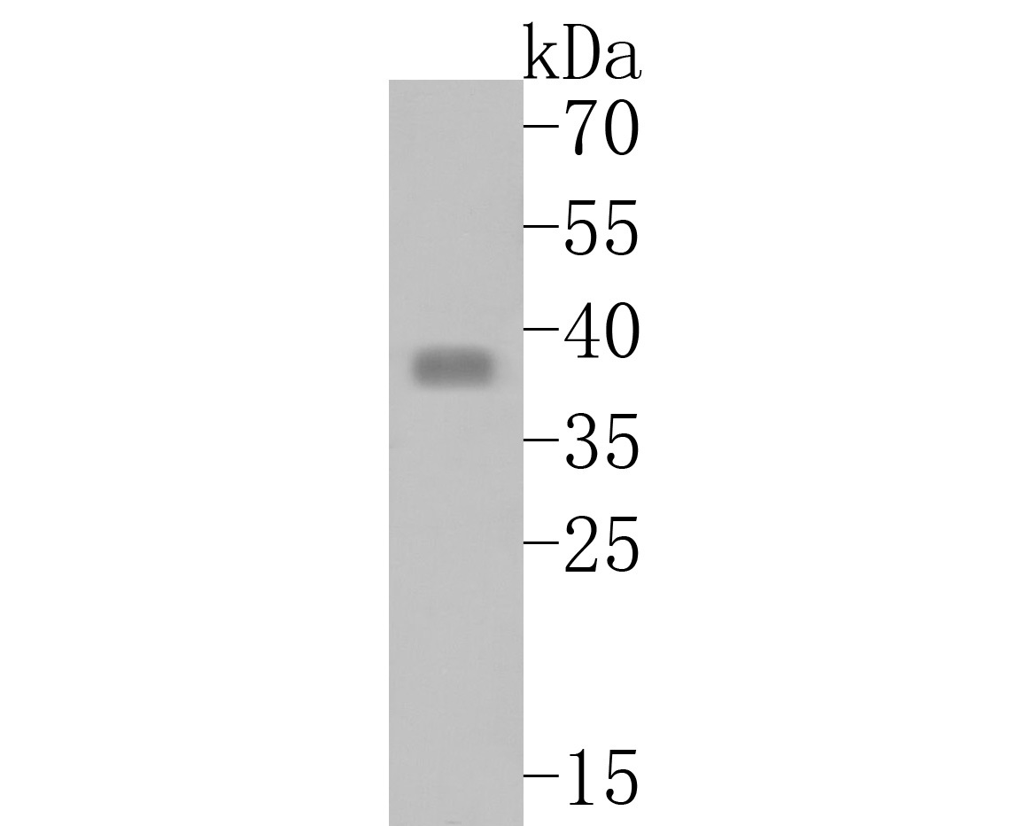 Fig2:; Western blot analysis of TMX4 on rat skin tissue lysates. Proteins were transferred to a PVDF membrane and blocked with 5% BSA in PBS for 1 hour at room temperature. The primary antibody ( 1/500) was used in 5% BSA at room temperature for 2 hours. Goat Anti-Rabbit IgG - HRP Secondary Antibody (HA1001) at 1:5,000 dilution was used for 1 hour at room temperature.
