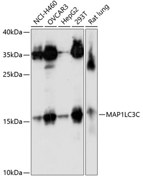 Western blot - MAP1LC3C Polyclonal Antibody 
