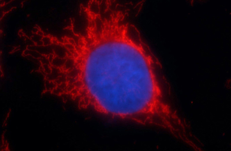Immunofluorescent analysis of HUVEC cells using Catalog No:115493(SOD2 Antibody) at dilution of 1:50 and Rhodamine-Goat anti-Rabbit IgG