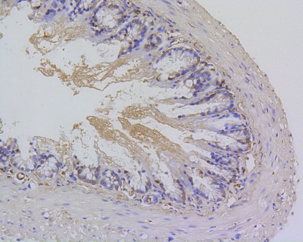 Fig4:; Immunohistochemical analysis of paraffin-embedded mouse colon tissue using anti-Survivin antibody. The section was pre-treated using heat mediated antigen retrieval with Tris-EDTA buffer (pH 8.0-8.4) for 20 minutes.The tissues were blocked in 5% BSA for 30 minutes at room temperature, washed with ddH; 2; O and PBS, and then probed with the primary antibody ( 1/50) for 30 minutes at room temperature. The detection was performed using an HRP conjugated compact polymer system. DAB was used as the chromogen. Tissues were counterstained with hematoxylin and mounted with DPX.