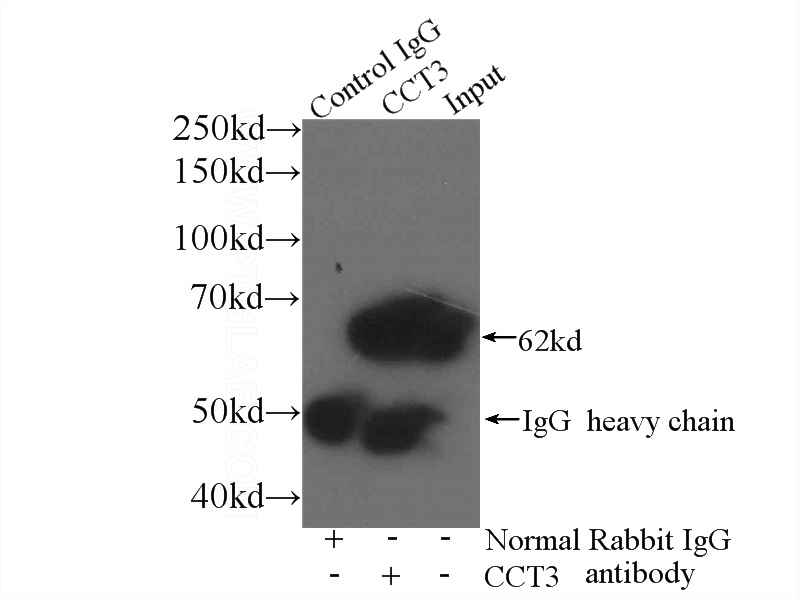 IP Result of anti-CCT3 (IP:Catalog No:109082, 3ug; Detection:Catalog No:109082 1:1000) with mouse brain tissue lysate 3600ug.