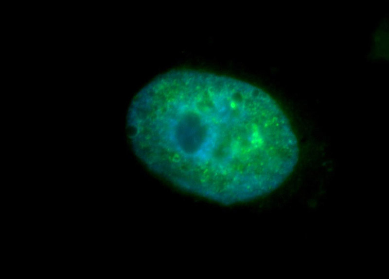 Immunofluorescent analysis of MCF-7 cells, using TCOF1 antibody Catalog No:115914 at 1:50 dilution and FITC-labeled donkey anti-rabbit IgG(green). Blue pseudocolor = DAPI (fluorescent DNA dye).
