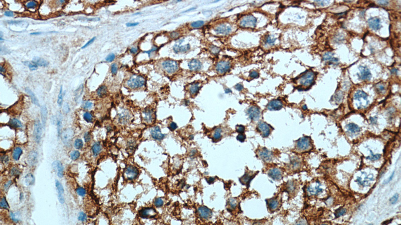 Immunohistochemical of paraffin-embedded human testis using Catalog No:109072(CCP1 antibody) at dilution of 1:50 (under 40x lens)
