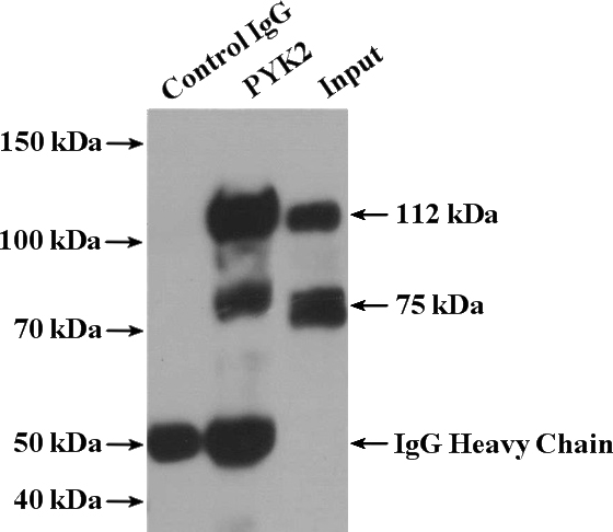 IP Result of anti-PTK2B (IP:Catalog No:114364, 4ug; Detection:Catalog No:114364 1:500) with mouse brain tissue lysate 2640ug.