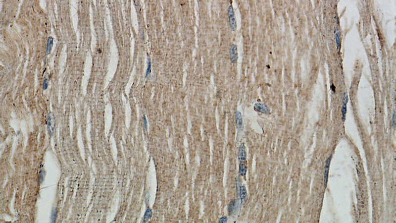 Immunohistochemistry of paraffin-embedded human skeletal muscle slide using Catalog No:107820(ABLIM2 Antibody) at dilution of 1:50