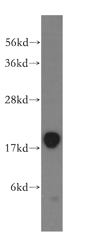 mouse skeletal muscle tissue were subjected to SDS PAGE followed by western blot with Catalog No:112976(MYLPF antibody) at dilution of 1:400