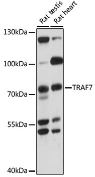 Western blot - TRAF7 Polyclonal Antibody 