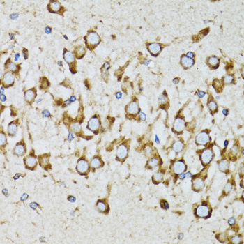 Immunohistochemistry - RPN1 Polyclonal Antibody 