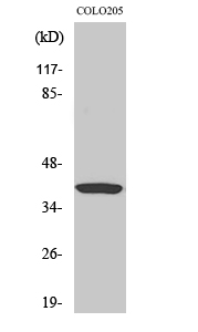 Fig1:; Western Blot analysis of various cells using Gα t1 Polyclonal Antibody diluted at 1: 2000