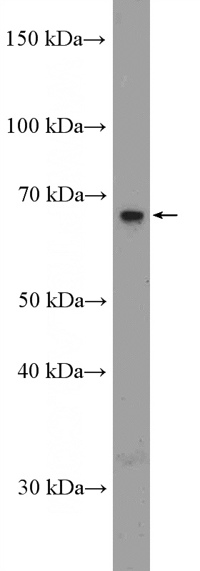 rat kidney tissue were subjected to SDS PAGE followed by western blot with Catalog No:115346(SLC5A8 Antibody) at dilution of 1:1000