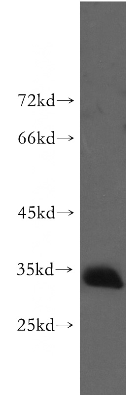 human skeletal muscle tissue were subjected to SDS PAGE followed by western blot with Catalog No:114210(Prnd antibody) at dilution of 1:1000