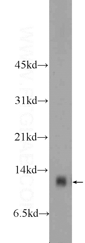 HeLa cells were subjected to SDS PAGE followed by western blot with Catalog No:109491(COX5A Antibody) at dilution of 1:800