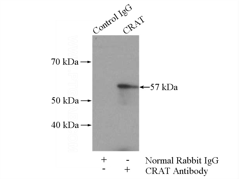 IP Result of anti-CRAT (IP:Catalog No:109538, 4ug; Detection:Catalog No:109538 1:300) with mouse skeletal muscle tissue lysate 3600ug.