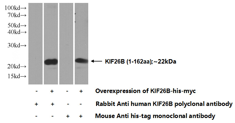 Transfected HEK-293 cells were subjected to SDS PAGE followed by western blot with Catalog No:112008(KIF26B Antibody) at dilution of 1:1000