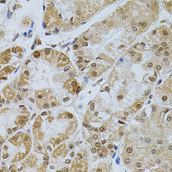 Immunohistochemistry - CDCA8 Polyclonal Antibody 