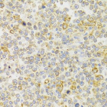 Immunohistochemistry - KISS1R Polyclonal Antibody 