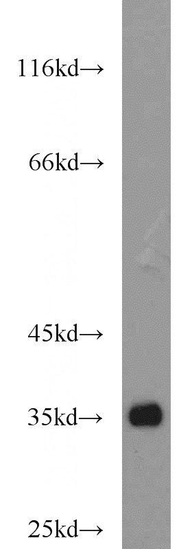 mouse brain tissue were subjected to SDS PAGE followed by western blot with Catalog No:114145(PPP1CC antibody) at dilution of 1:500