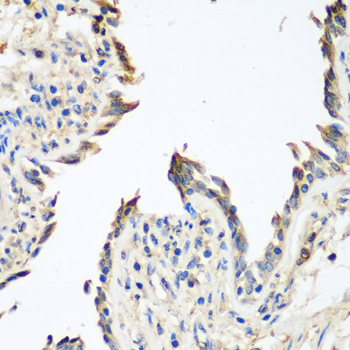 Immunohistochemistry - GPI Polyclonal Antibody 
