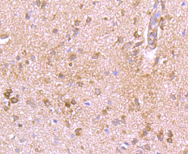 Fig4: Immunohistochemical analysis of paraffin-embedded rat brain tissue using anti-Kv1.4 antibody. Counter stained with hematoxylin.