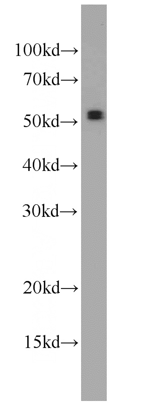 3T3-L1 cells were subjected to SDS PAGE followed by western blot with Catalog No:108329(ATGL antibody) at dilution of 1:500