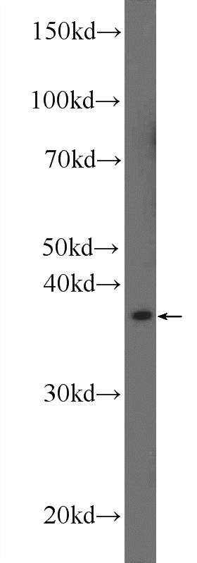 mouse testis tissue were subjected to SDS PAGE followed by western blot with Catalog No:107832(AGPAT3 Antibody) at dilution of 1:1000