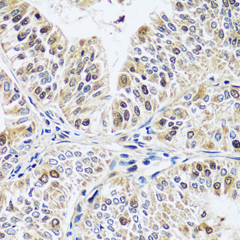 Immunohistochemistry - CCDC59 Polyclonal Antibody 
