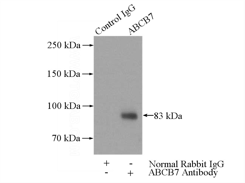 IP Result of anti-ABCB7 (IP:Catalog No:107686, 4ug; Detection:Catalog No:107686 1:500) with mouse liver tissue lysate 4000ug.