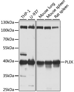 Western blot - PLEK Polyclonal Antibody 