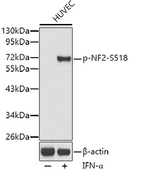 Western blot - Phospho-NF2-S518 pAb 