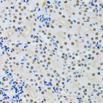 Immunohistochemistry - MTA3 Polyclonal Antibody 
