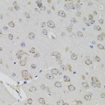 Immunohistochemistry - ACE Polyclonal Antibody 