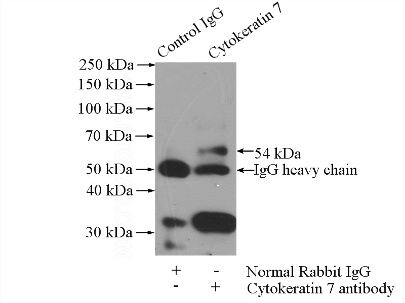 IP Result of anti-CK7-specific (IP:Catalog No:109812, 4ug; Detection:Catalog No:109812 1:500) with mouse liver tissue lysate 4000ug.