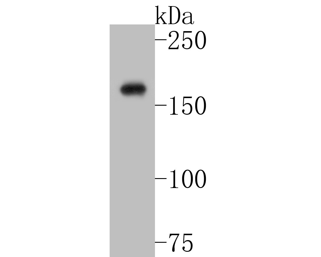Fig1:; Western blot analysis of Neurocan on SiHa cell lysates. Proteins were transferred to a PVDF membrane and blocked with 5% BSA in PBS for 1 hour at room temperature. The primary antibody ( 1/500) was used in 5% BSA at room temperature for 2 hours. Goat Anti-Rabbit IgG - HRP Secondary Antibody (HA1001) at 1:200,000 dilution was used for 1 hour at room temperature.