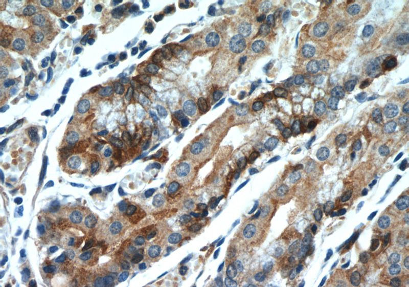 Immunohistochemistry of paraffin-embedded human stomach slide using Catalog No:107284(FUT9 Antibody) at dilution of 1:50