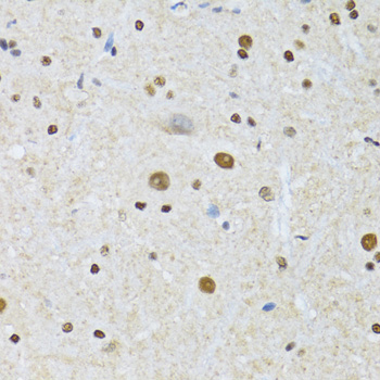 Immunohistochemistry - MTA3 Polyclonal Antibody 