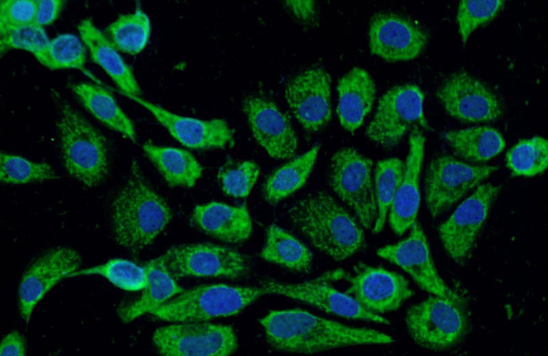 Immunofluorescent analysis of A431 cells using Catalog No:114122(PPFIBP2 Antibody) at dilution of 1:25 and Alexa Fluor 488-congugated AffiniPure Goat Anti-Rabbit IgG(H+L)