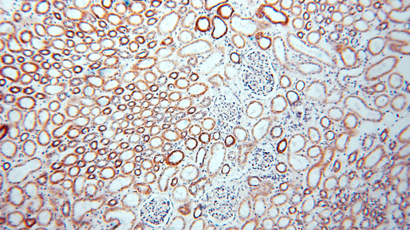 Immunohistochemical of paraffin-embedded human kidney using Catalog No:109987(DLD antibody) at dilution of 1:100 (under 10x lens)