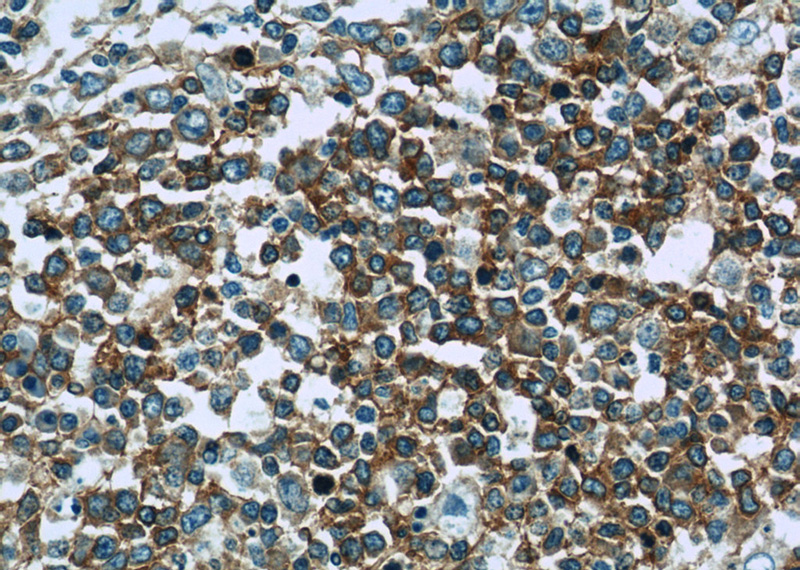 Immunohistochemistry of paraffin-embedded human tonsillitis slide using Catalog No:114631(RFTN1 Antibody) at dilution of 1:50 (under 40x lens)