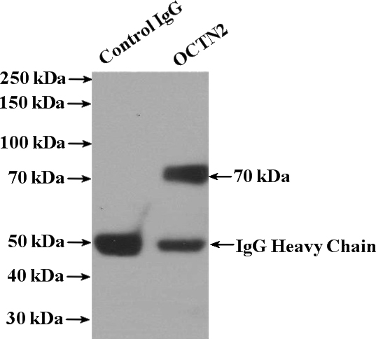 IP Result of anti-SLC22A5 (IP:Catalog No:113320, 4ug; Detection:Catalog No:113320 1:500) with mouse skeletal muscle tissue lysate 2200ug.