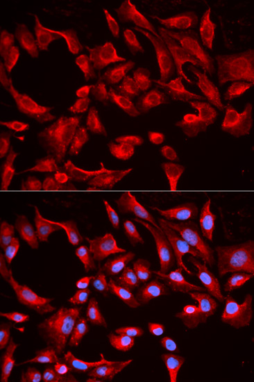Immunofluorescence - BCL2L13 Polyclonal Antibody 