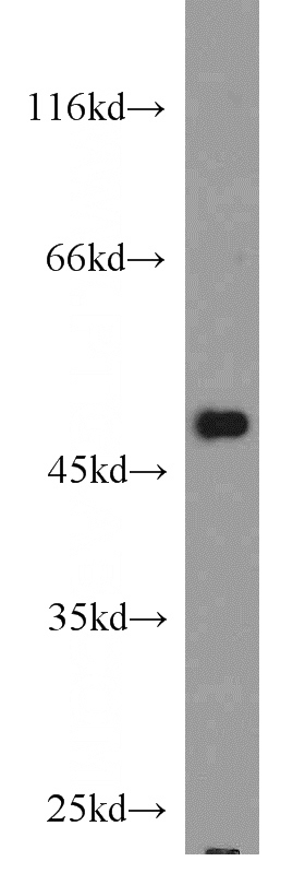 HL-60 cells were subjected to SDS PAGE followed by western blot with Catalog No:109597(CSK antibody) at dilution of 1:800