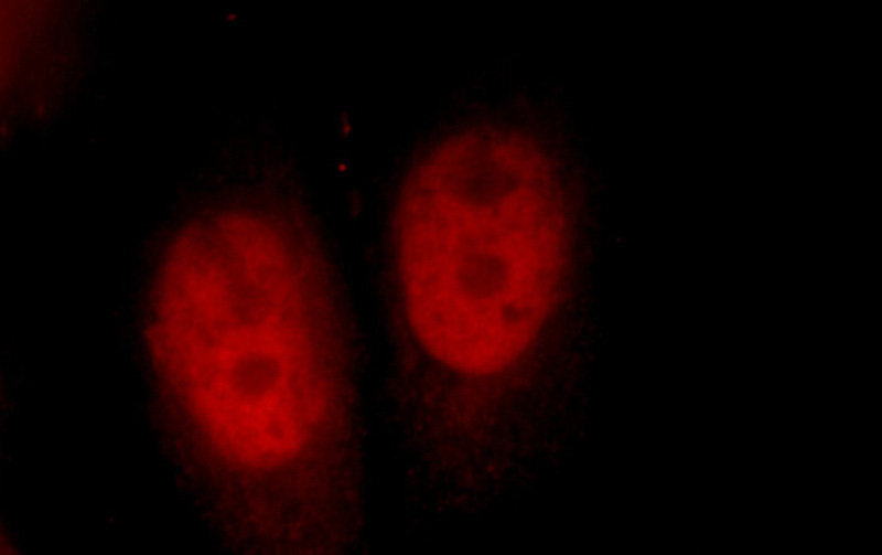 Immunofluorescent analysis of HepG2 cells, using CUL4B antibody Catalog No:109746 at 1:25 dilution and Rhodamine-labeled goat anti-rabbit IgG (red).
