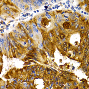 Immunohistochemistry - TFF1 Polyclonal Antibody 