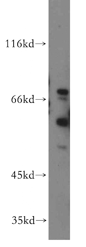 SH-SY5Y cells were subjected to SDS PAGE followed by western blot with Catalog No:111464(HRH2 antibody) at dilution of 1:500